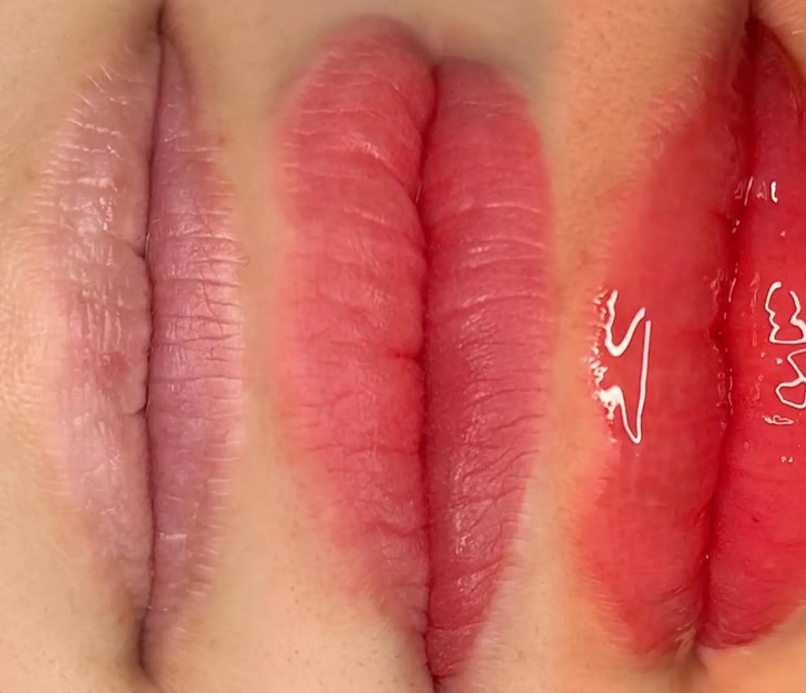 cold sore prevention lip tattoo