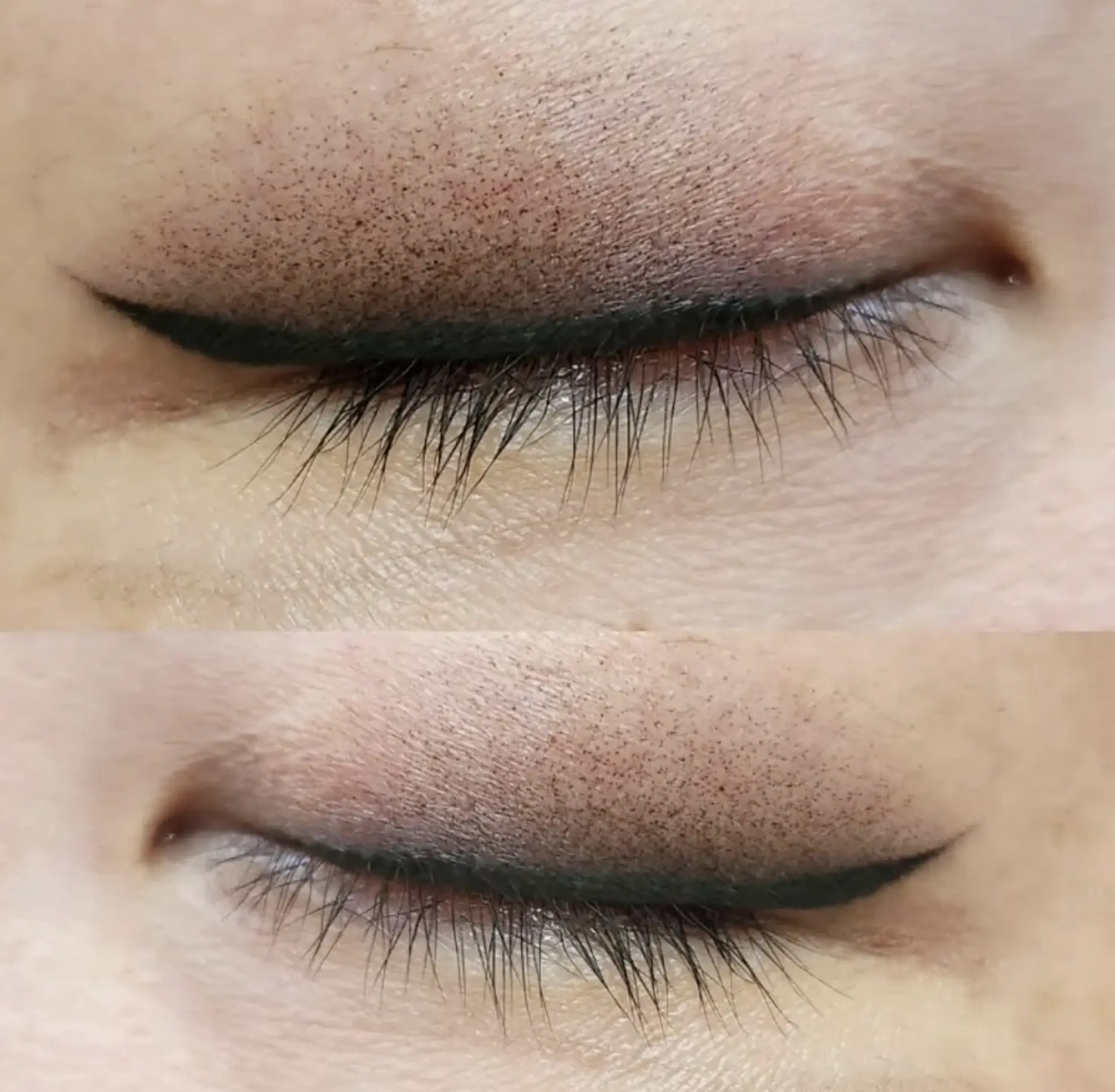 Cosmetic tattoo aftercare
